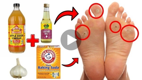 remover fungos e calos nos pes